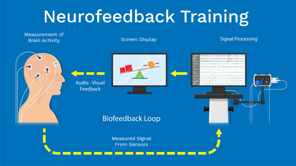 Neurofeedback diagram